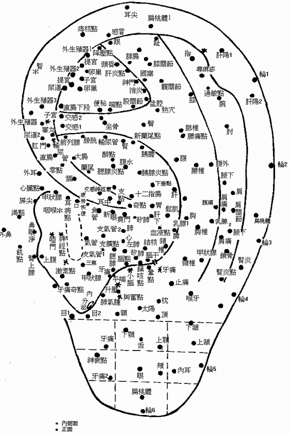 耳诊图解大全清晰图图片