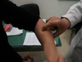 要控血压 不妨灸曲池