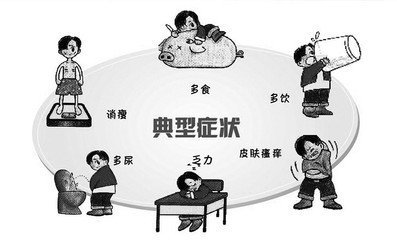 女性糖尿病的早期症状有哪些