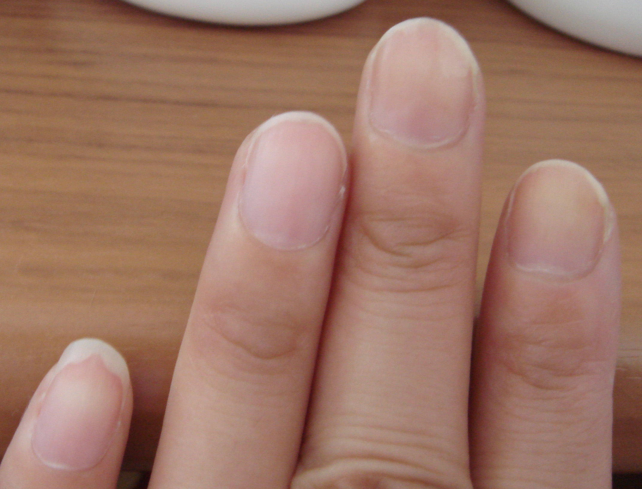 指甲的12个健康秘密